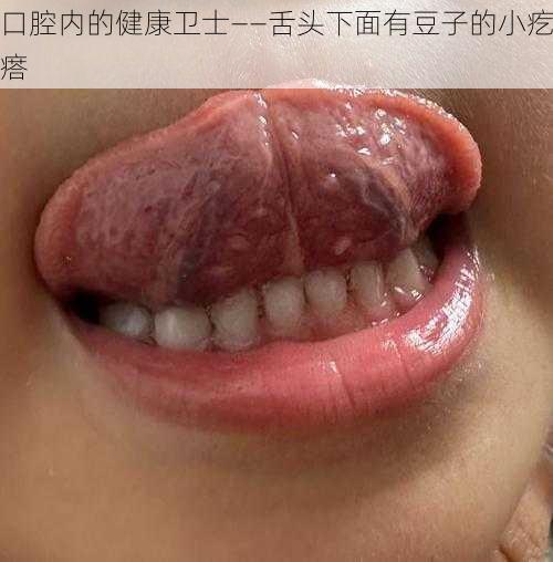 口腔内的健康卫士——舌头下面有豆子的小疙瘩